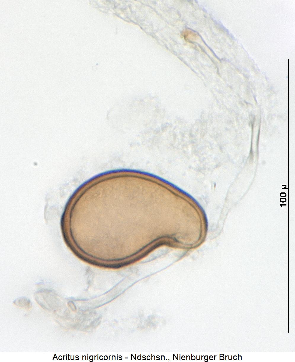 acritus_nigricornis_sperm.jpg