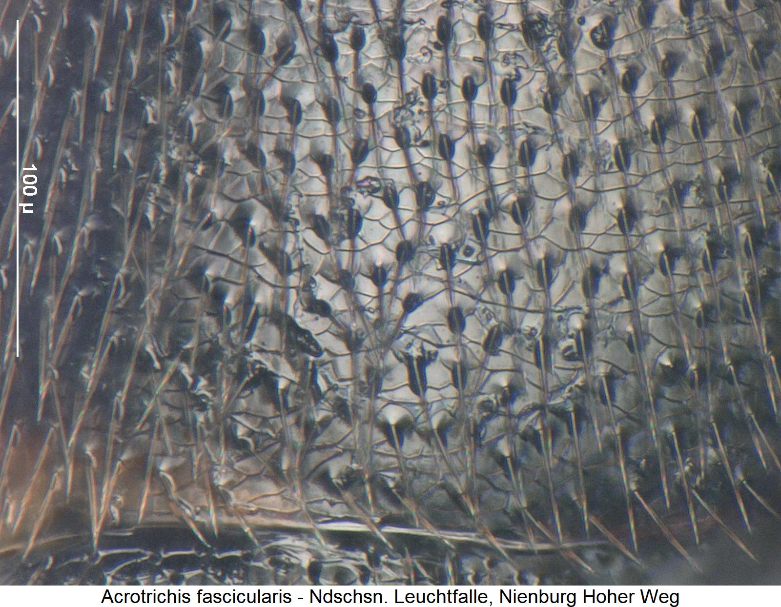 acrotrichis_fascicularis_ms.jpg