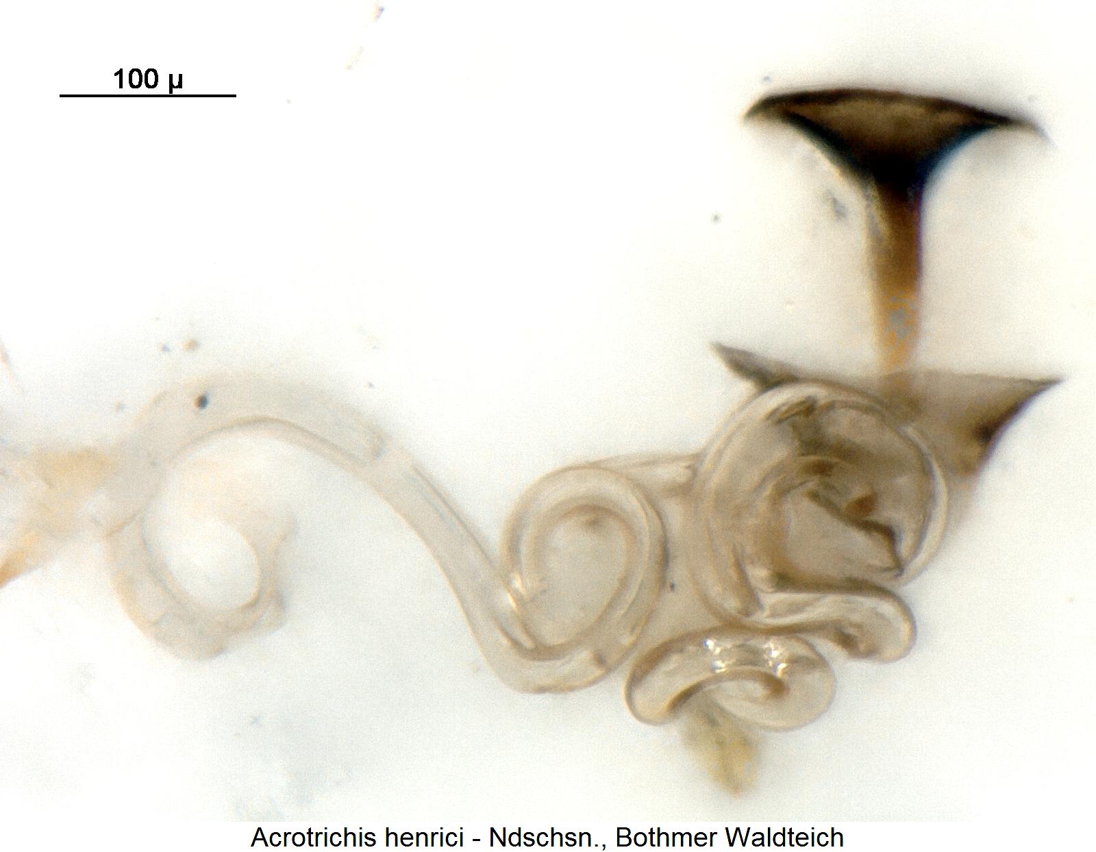 acrotrichis_henrici_sperm.jpg