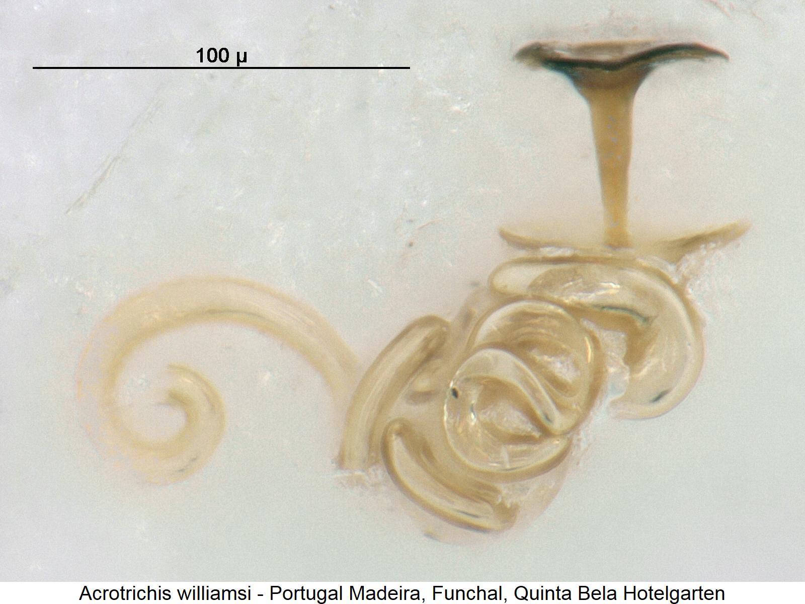 acrotrichis_williamsi_sperm2.jpg