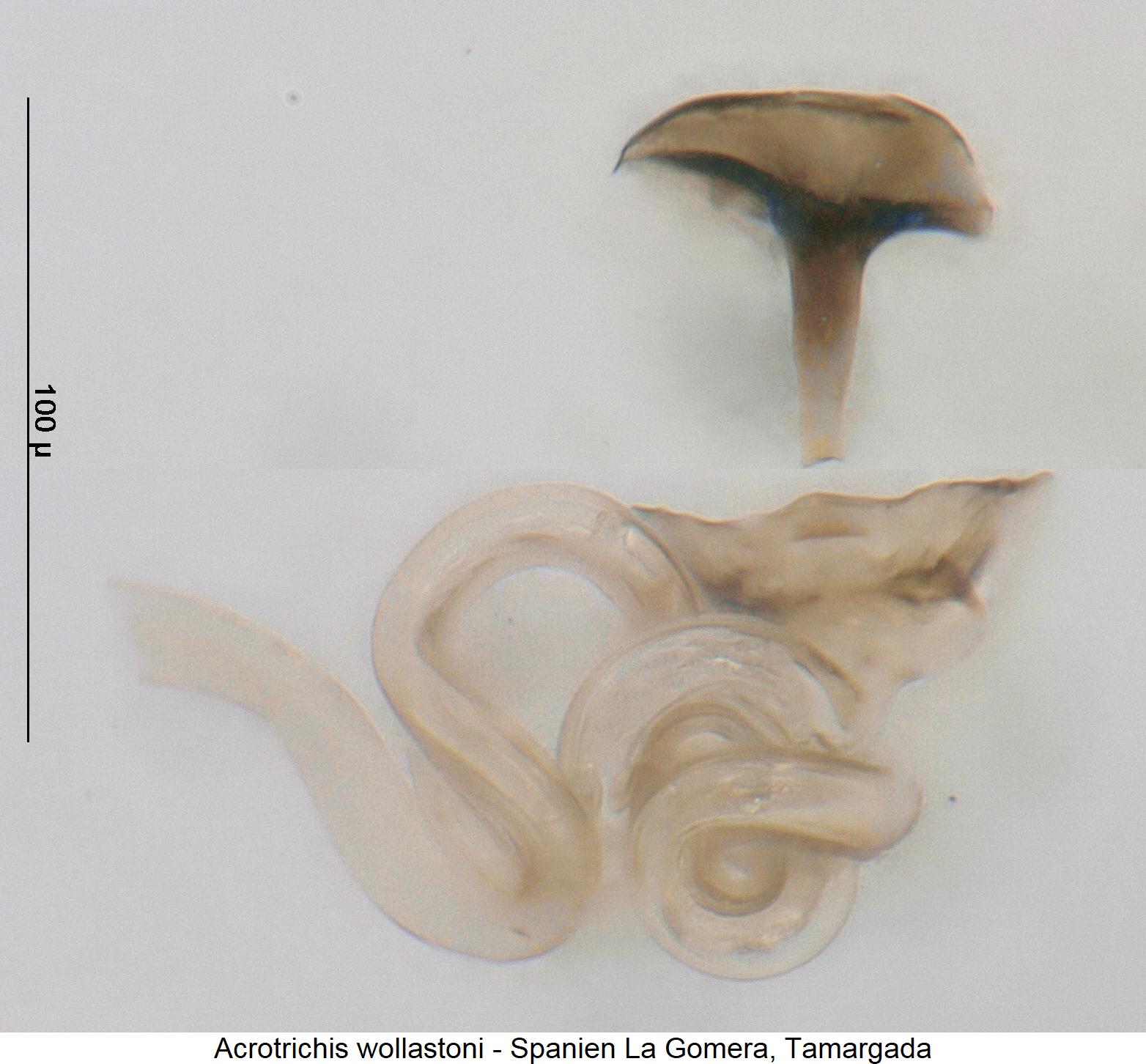 acrotrichis_wollastoni_sperm1.jpg