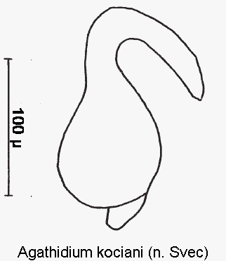 agathidium_kociani_sperm.gif