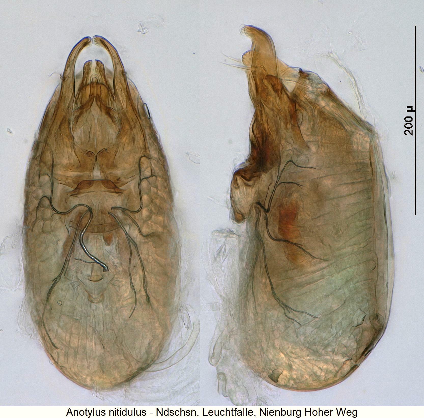 anotylus_nitidulus1.jpg