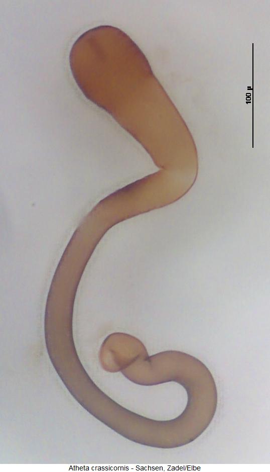 atheta_crassicornis_sperm.jpg