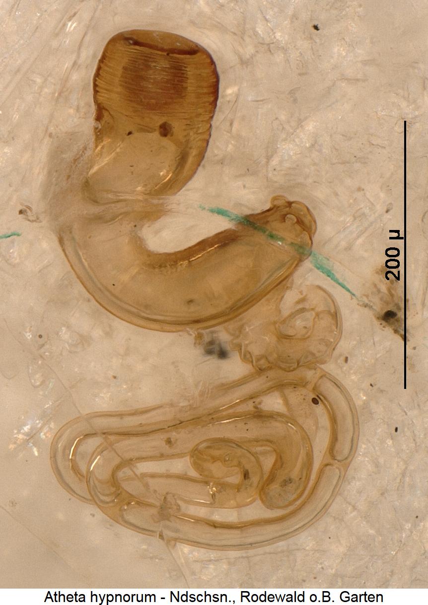 atheta_hypnorum_sperm.jpg