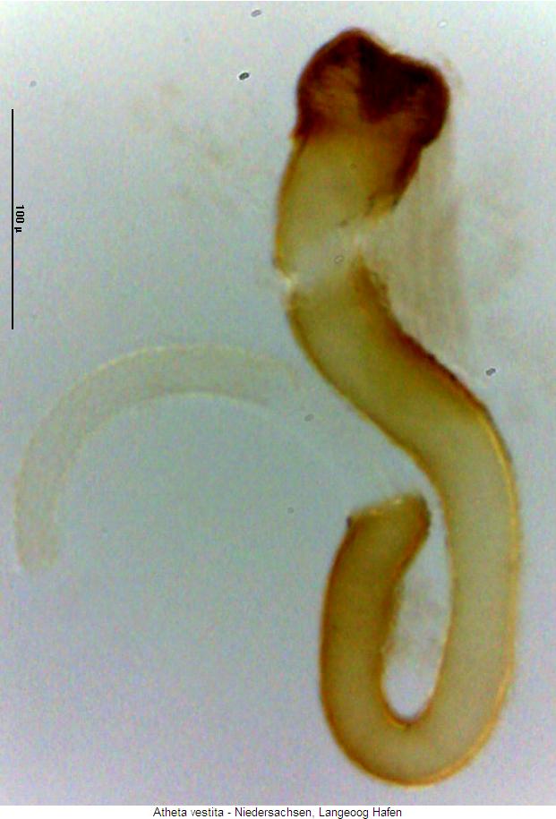 atheta_vestita_sperm.jpg