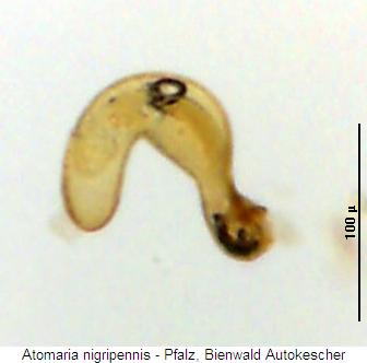 atomaria_nigripennis_sperm.jpg