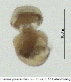 bledius_praetermissus_sperm.jpg