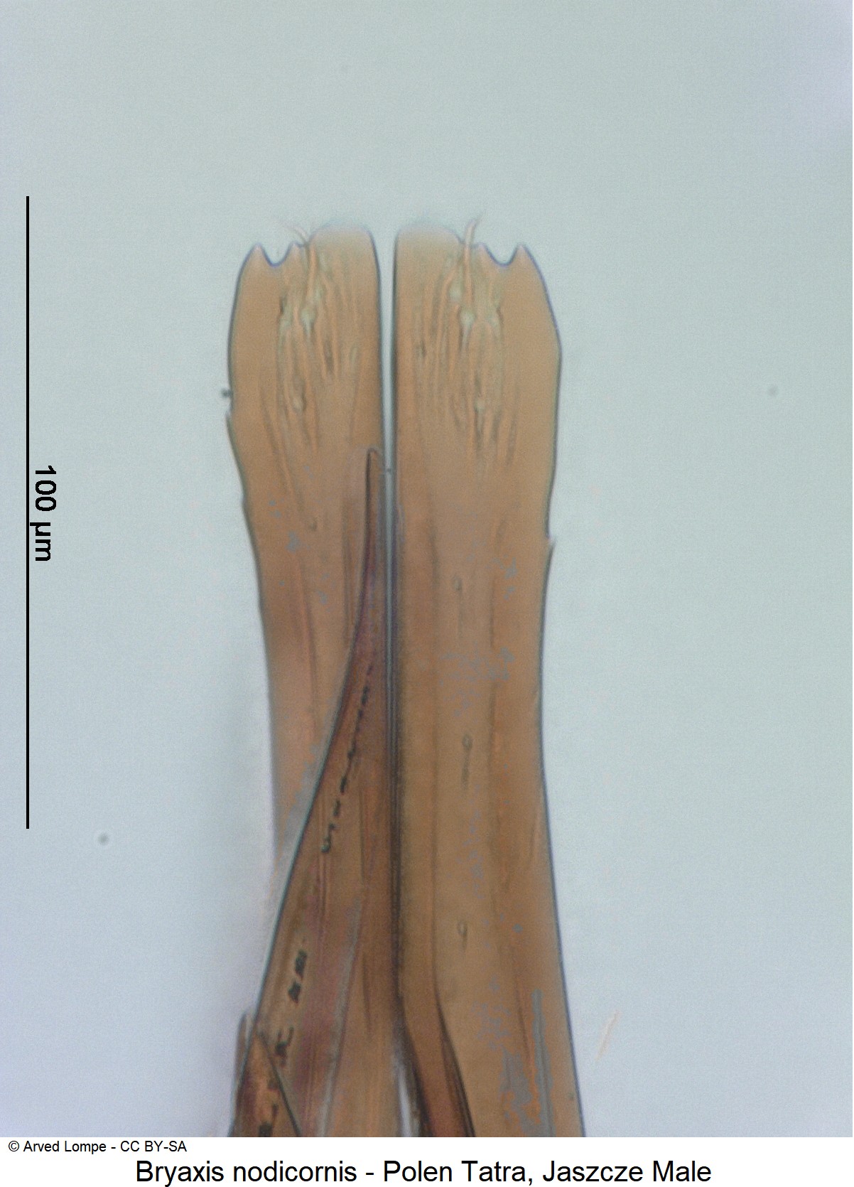 bryaxis_nodicornis_ck34587480_detail.jpg