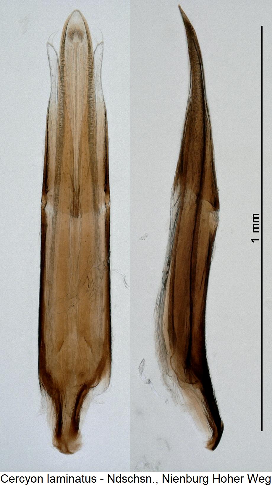 cercyon_laminatus.jpg