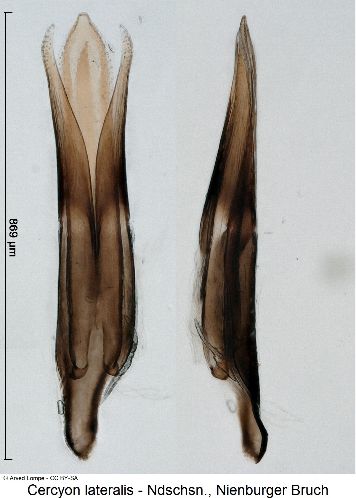cercyon_lateralis_ck35950343.jpg