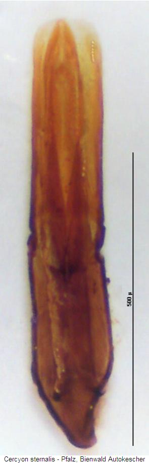 cercyon_sternalis.jpg