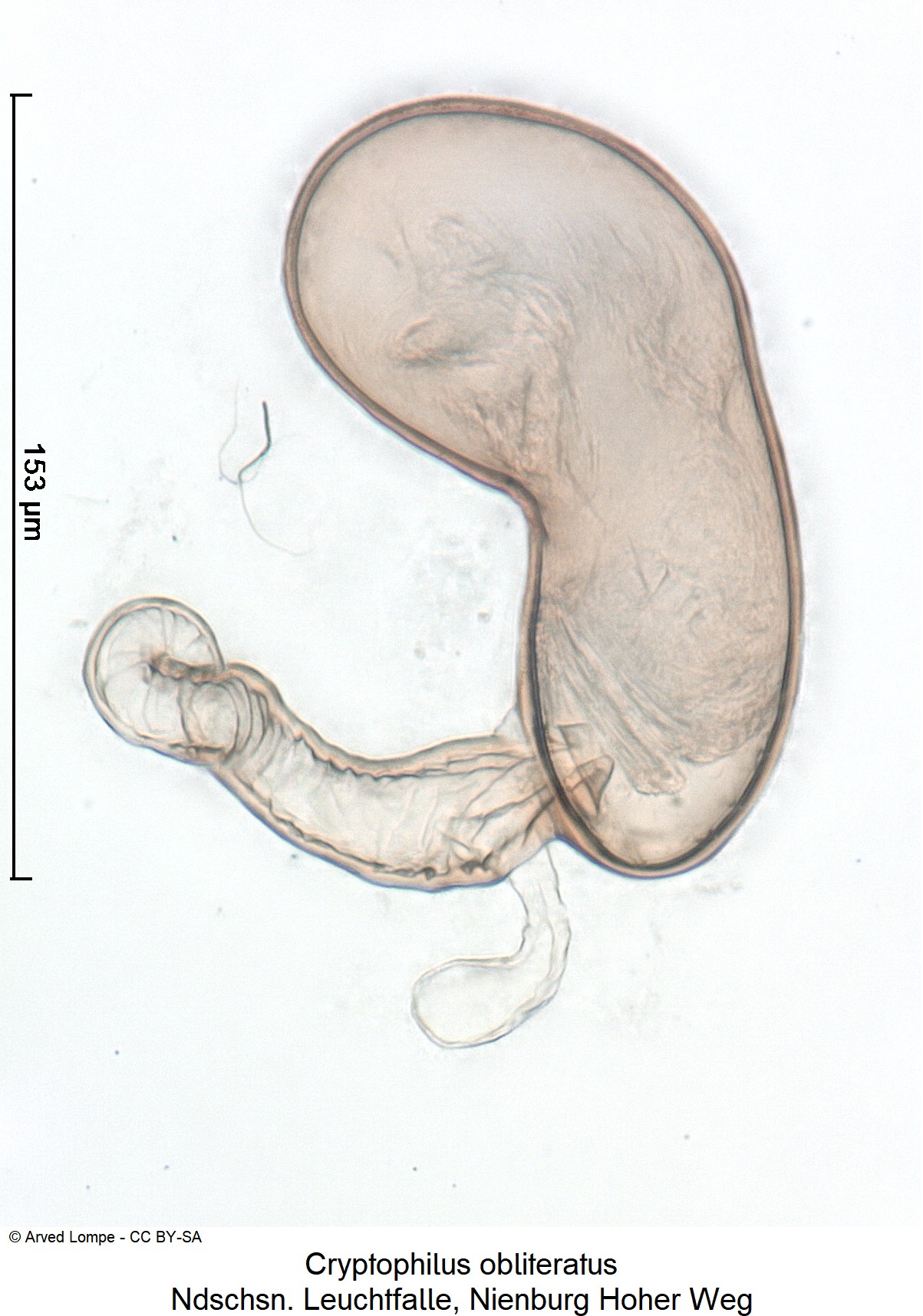 cryptophilus_obliteratus_ck38099802_sperm.jpg