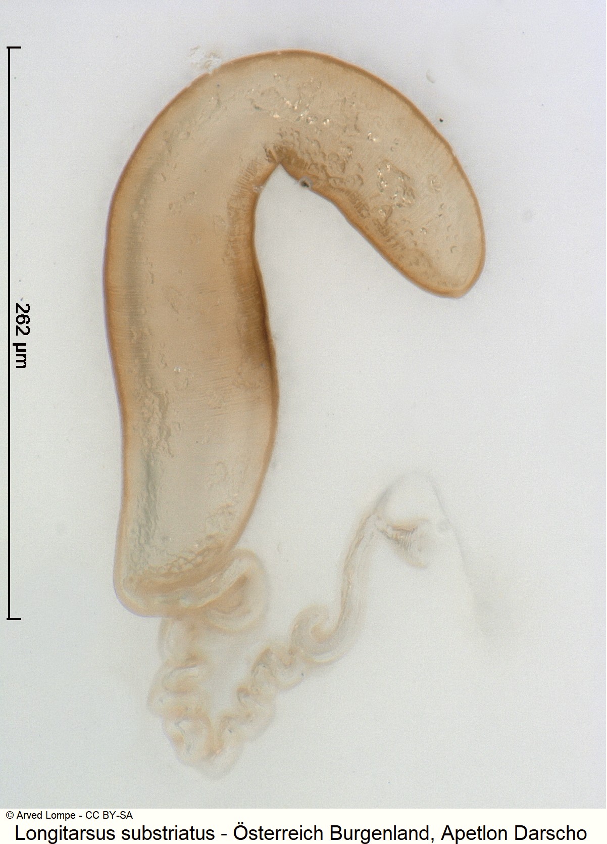 longitarsus_substriatus_ck35237513_sperm.jpg