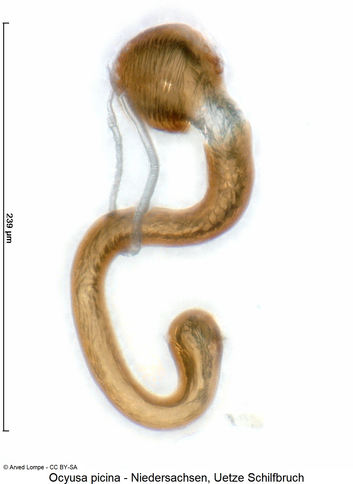ocyusa_picina_$29950775_sperm.jpg