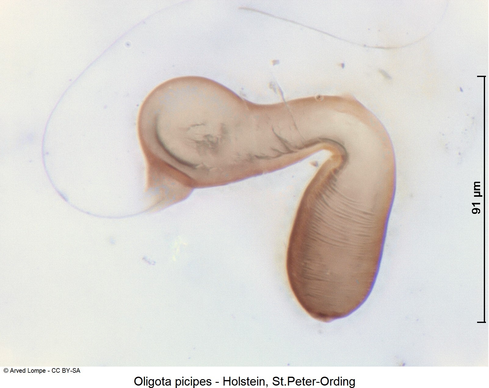 oligota_picipes_ck37186037_sperm.jpg