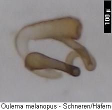 oulema_melanopus_sperm2.jpg