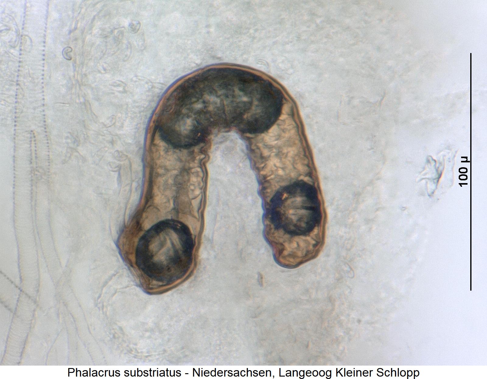 phalacrus_substriatus_sperm.jpg