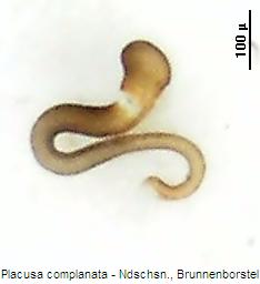 placusa_complanata_sperm.jpg
